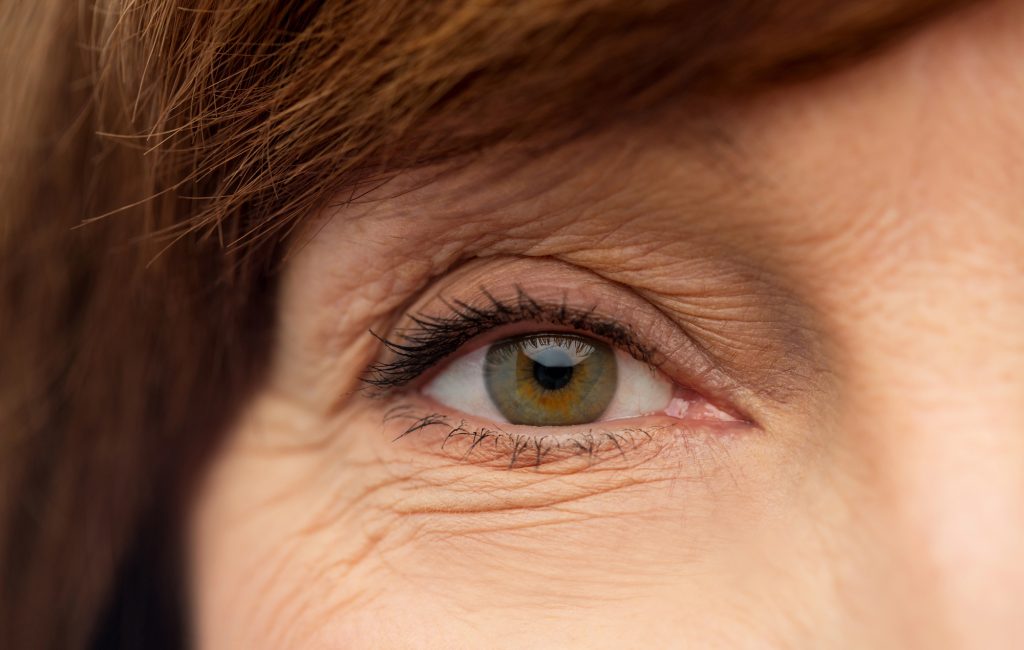 Simple Reasons Forehead Lines Can Look Deeper Over Time