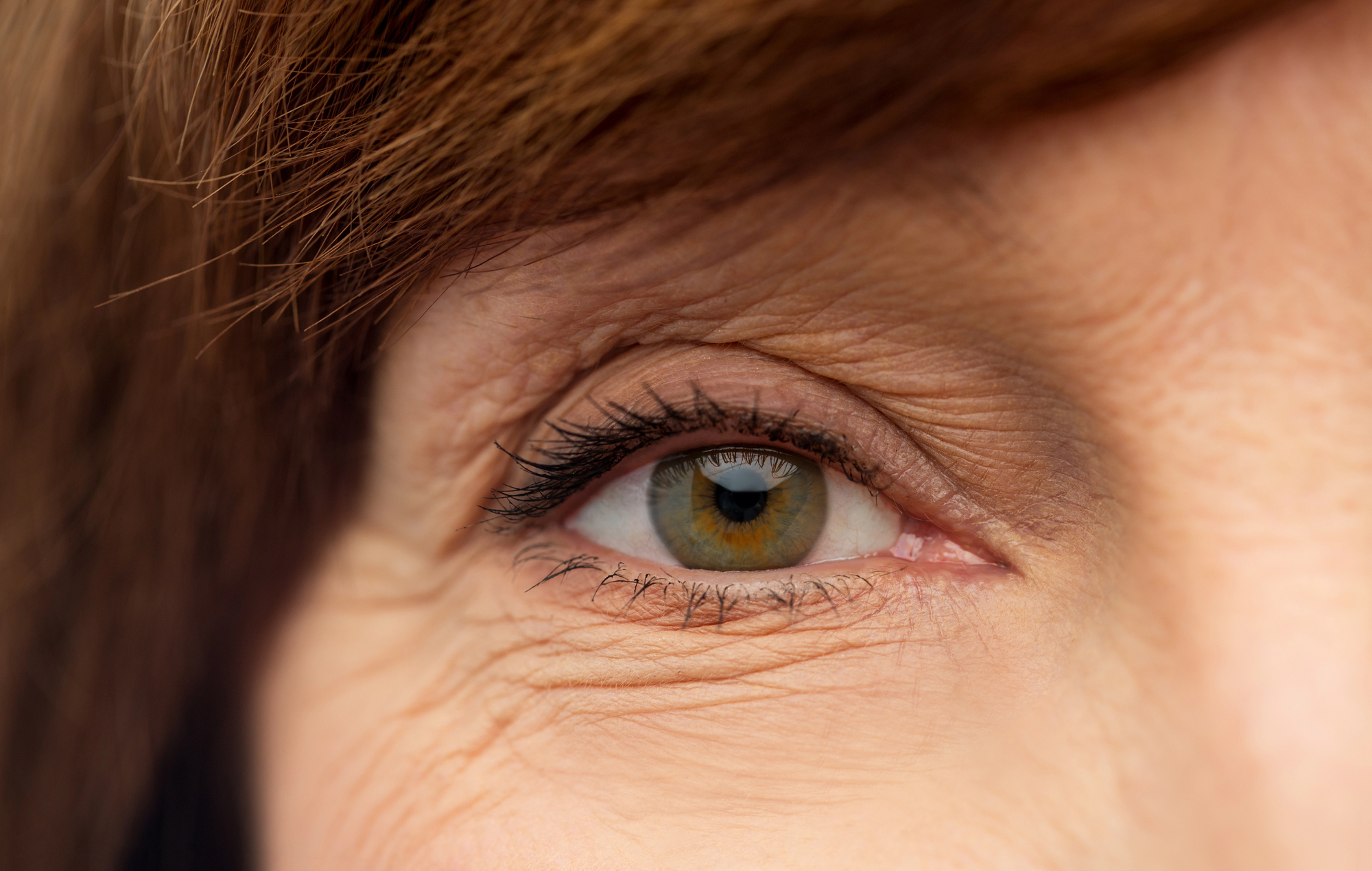 Simple Reasons Forehead Lines Can Look Deeper Over Time